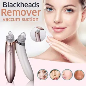 Electric Blackheads Remover Beauty Tool